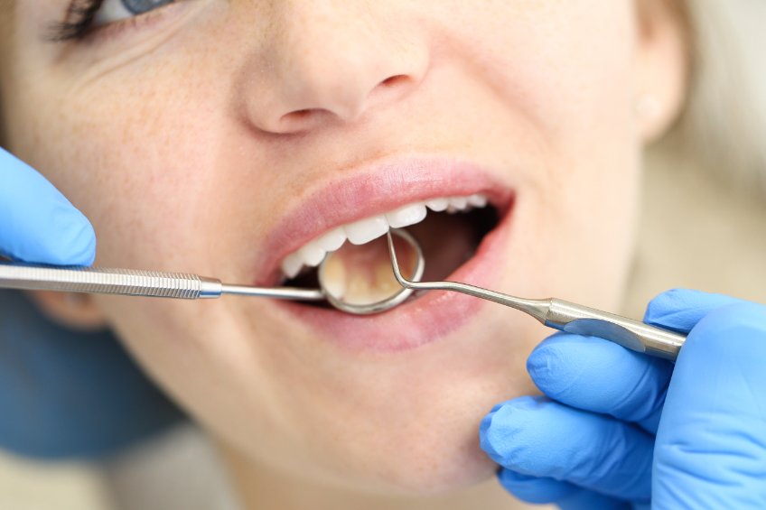 Kto może skorzystać z leczenia stomatologicznego na raty?